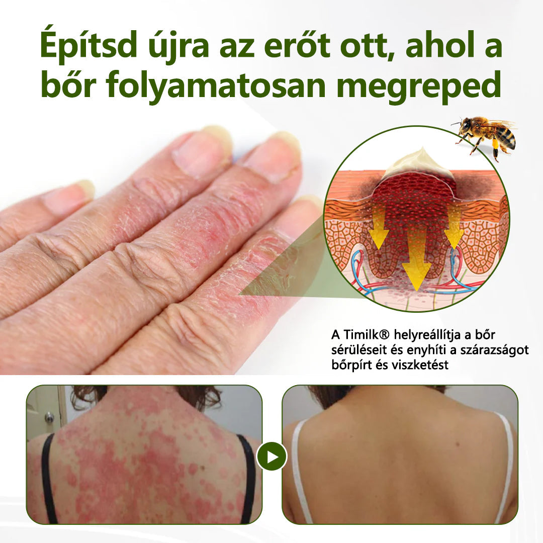 🔥🔥Laleia® MéhPeptid GyökérPuhító Kétirányú Megkönnyebbülés Krém