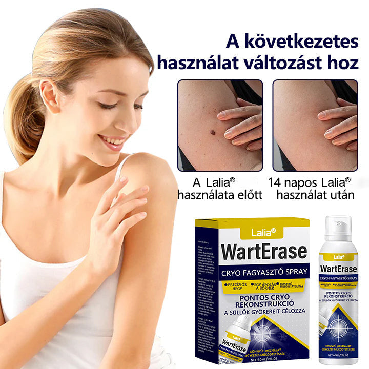 🔥Laleia® WartErase – Fagyasztó Szemölcseltávolító Spray