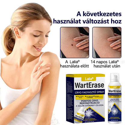 🔥Laleia® WartErase – Fagyasztó Szemölcseltávolító Spray