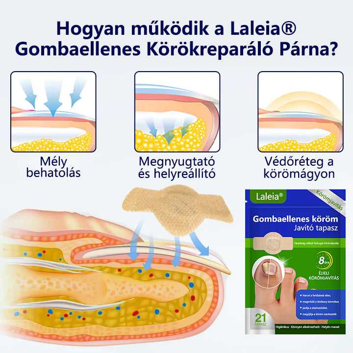 🔥🔥Laleia® Gombaellenes körömjavító tapasz