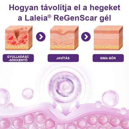 🔥🔥🔥Laleia® ReGenScar őssejt-heg gél