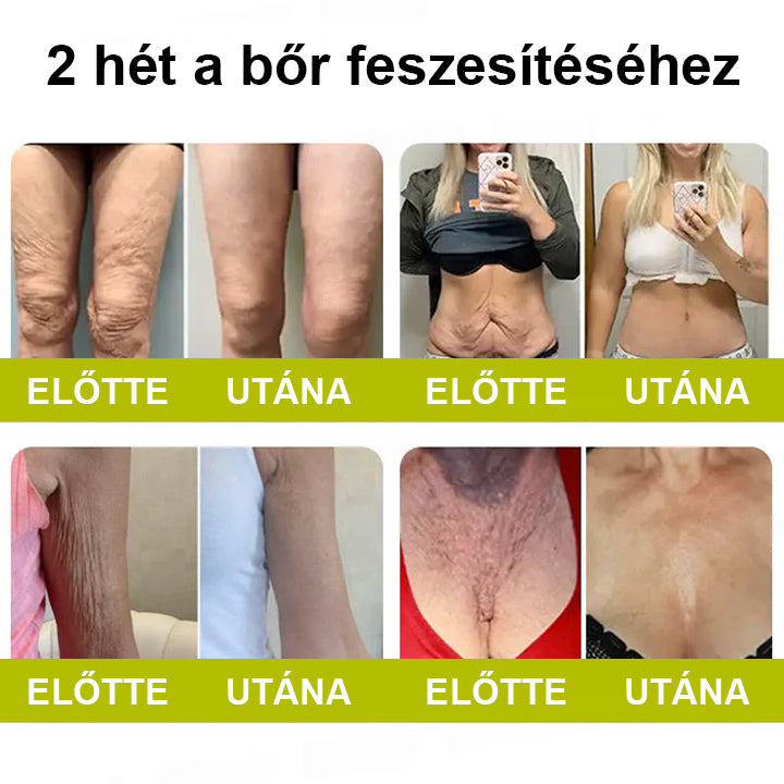 🌿🌿Laleia® Botox & Retinol Shot – Simaabb bőr mély ráncok, megereszkedett áll és duzzadt szemek ellen