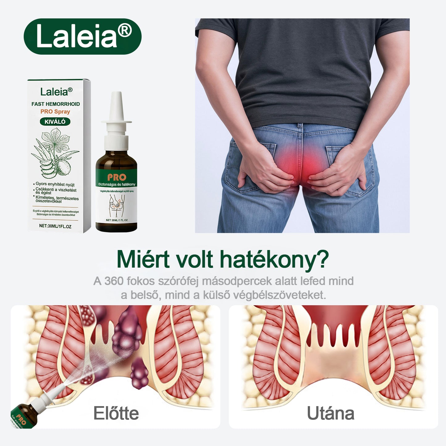 🎁🎁Laleia® Gyors Aranyér PRO Spray