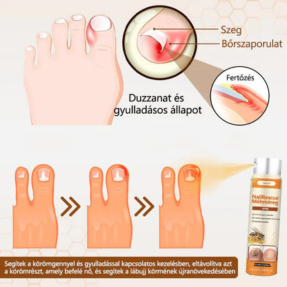 ✅✅✅Laleia® NailRescue méhméreg spray