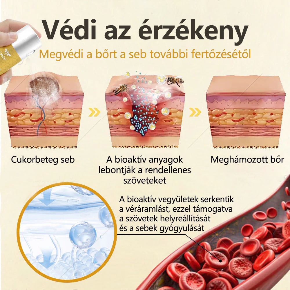 Laleia®GlucoShield méhméreges sebfertőtlenítő spray🔥
