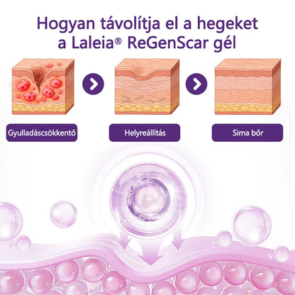Laleia® ReGenScar Őssejtes hegkezelő gél