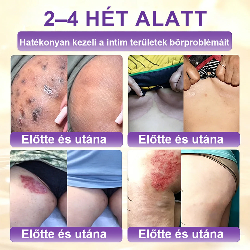 ✨Laleia® Biotin 10 az 1-ben bőr helyreállító krém