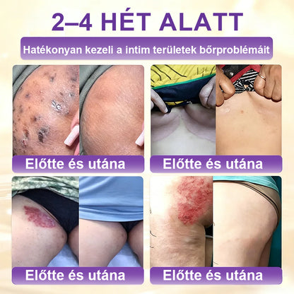 ✨Laleia® Biotin 10 az 1-ben bőr helyreállító krém