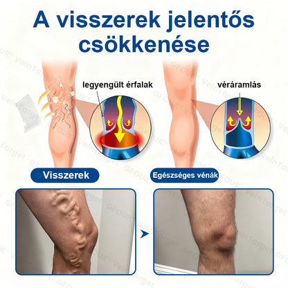 ✅✅Laleia® Vein Ease mikrotűs tapasz