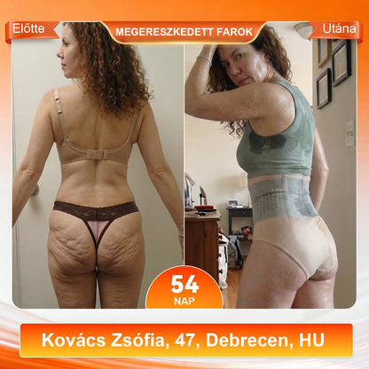 💪💪💪 Laleia® 2026 Moringa & Berberine 4 az 1-ben Mikrorészecskés Formáló és Zsírégető Rövidnadrág