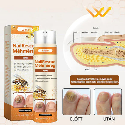 ✅✅✅Laleia® NailRescue méhméreg spray