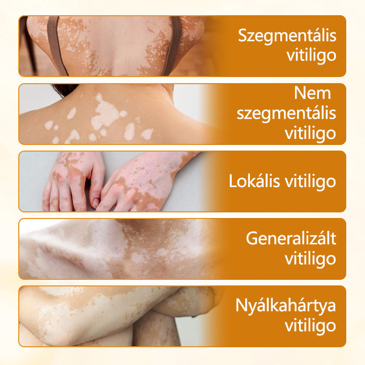 Laleia® VitiCalm méhméreg-krém🌻🌻