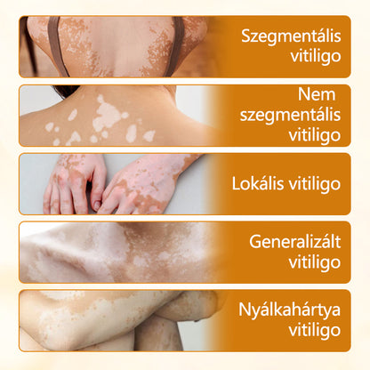 Laleia® VitiCalm méhméreg-krém🌻🌻