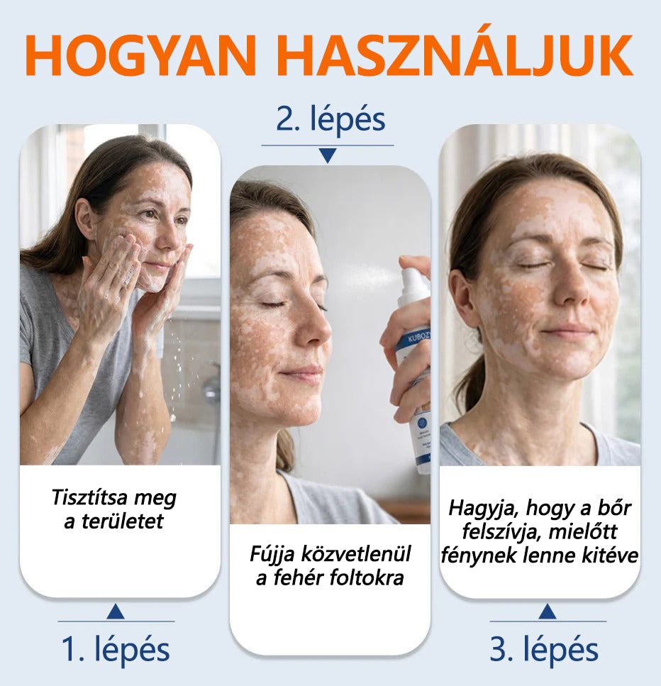 🌿🌿Laleia® Piperine Repigment Aktivátor Spray