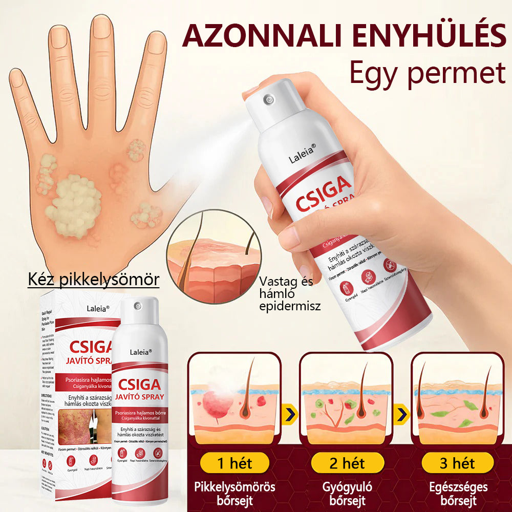 🔥🔥Laleia® csigahéjas spray viszkető, hámló pikkelysömörös bőrre