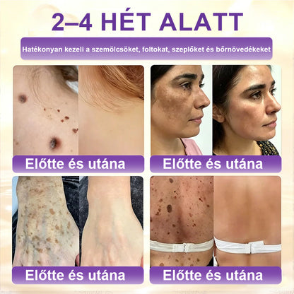 ✨Laleia® Biotin 10 az 1-ben bőr helyreállító krém