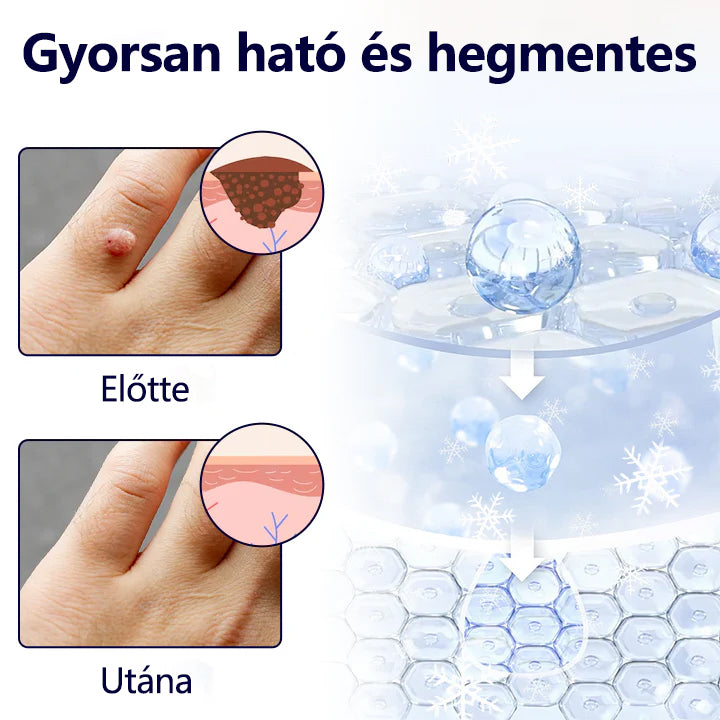 🔥Laleia® WartErase – Fagyasztó Szemölcseltávolító Spray