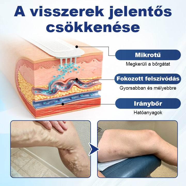 💎Laleia® Mélyvénás Javító Mikrotűs Tapasz