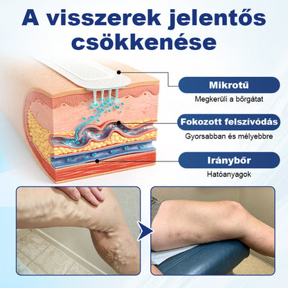 💎Laleia® Mélyvénás Javító Mikrotűs Tapasz