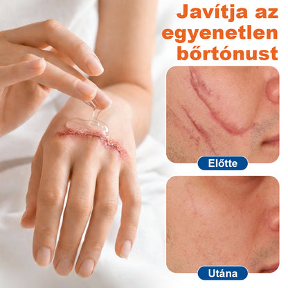 🔥🔥Laleia® DermalRebuild bőrfiatalító gél