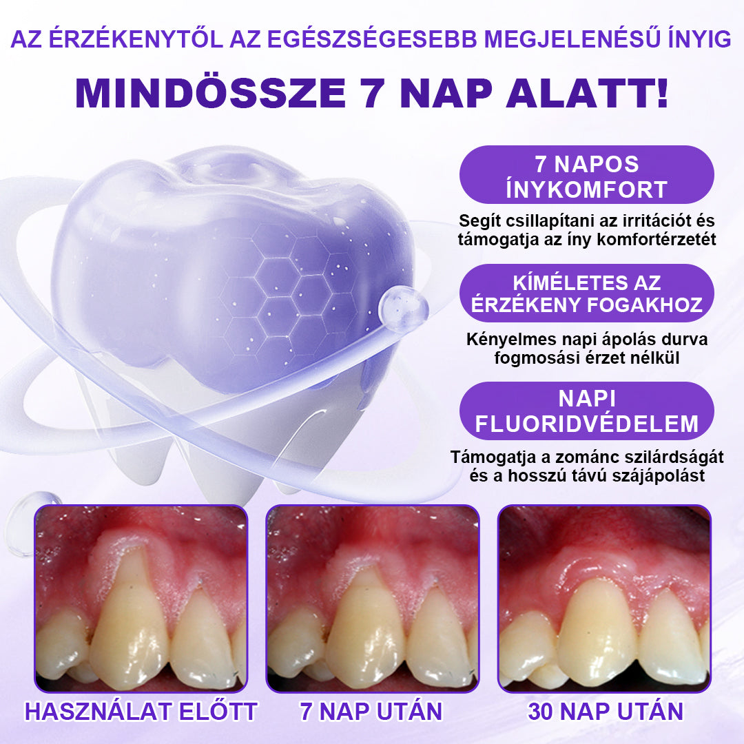 ⭐Laleia® SensiGum Fluoridos Fogkrém