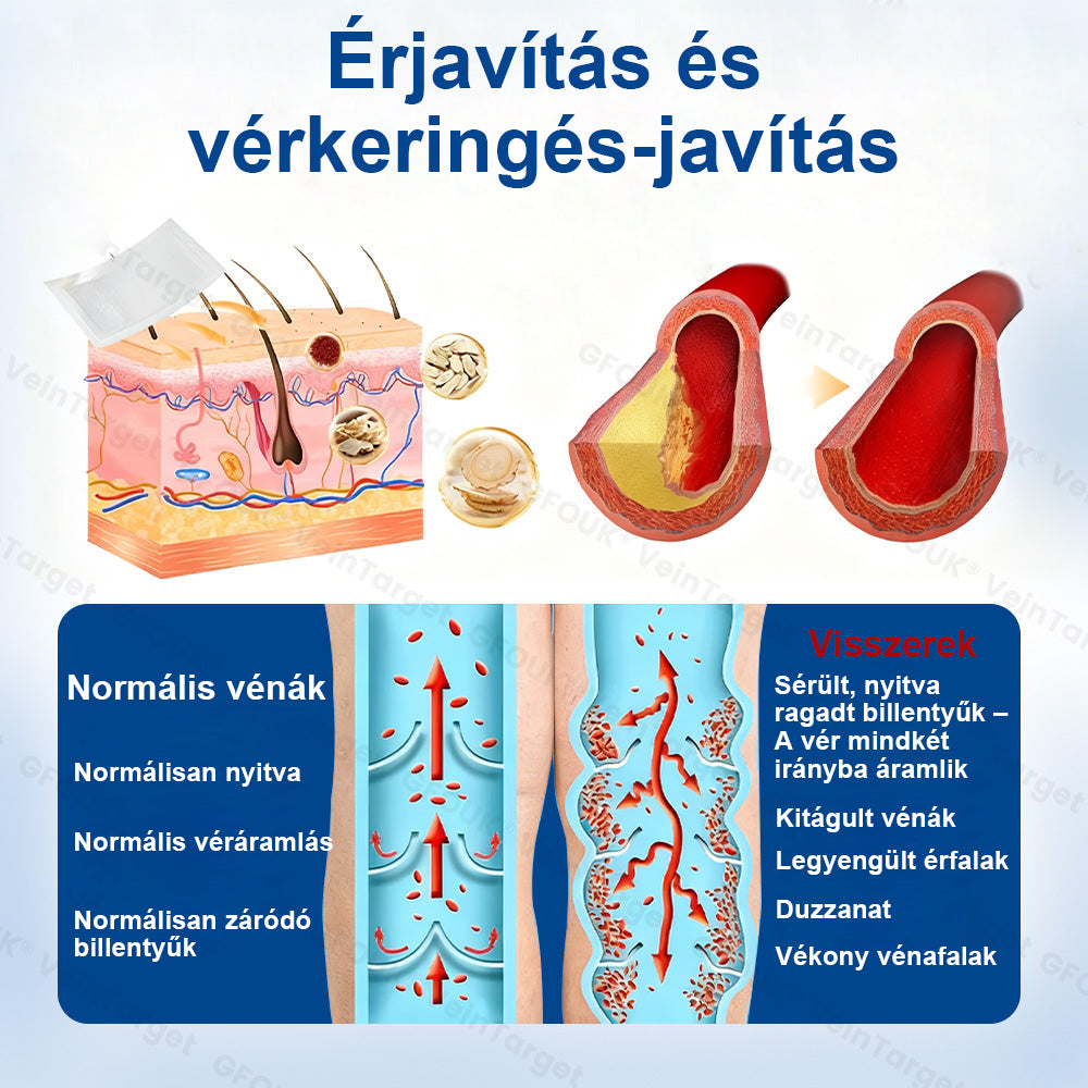 ✅✅Laleia® Vein Ease mikrotűs tapasz