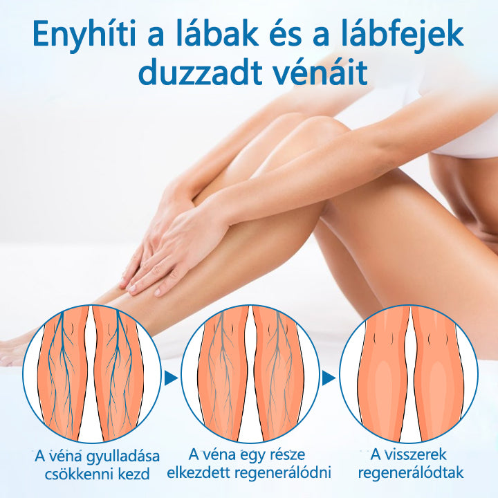 Laleia® VeinGuard Herbal Spray-✅✅✅ Klinikailag bizonyítottan 7 nap alatt megszünteti a visszerességet!