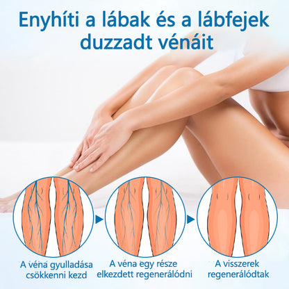 Laleia® VeinGuard Herbal Spray-✅✅✅ Klinikailag bizonyítottan 7 nap alatt megszünteti a visszerességet!
