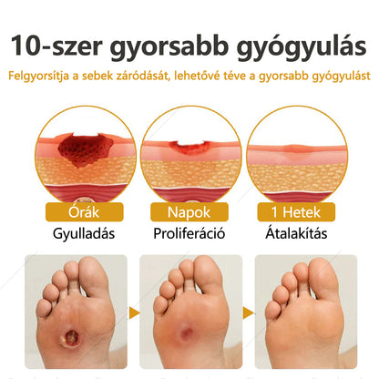 Laleia®GlucoShield méhméreges sebfertőtlenítő spray🔥