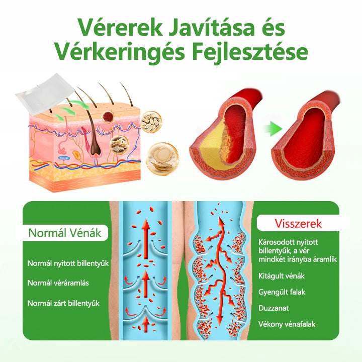 🔥🔥🔥Laleia® VeinHeal mikrotűs tapasz
