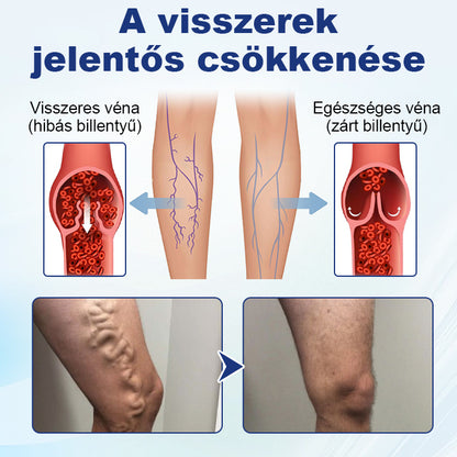 💎Laleia® Mélyvénás Javító Mikrotűs Tapasz