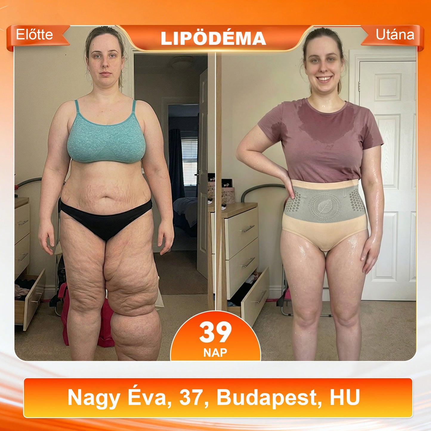 💪💪💪 Laleia® 2026 Moringa & Berberine 4 az 1-ben Mikrorészecskés Formáló és Zsírégető Rövidnadrág