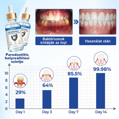 🌿🌿Laleia® GumHony szájüregi helyreállító cseppek