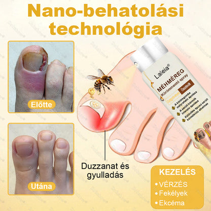 🌿 Laleia® Méhméreg Körömmentő Spray