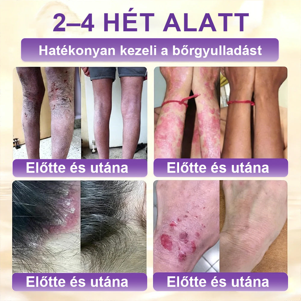 ✨Laleia® Biotin 10 az 1-ben bőr helyreállító krém