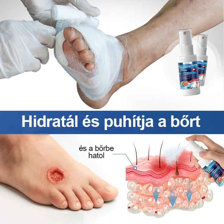 Laleia® GlucoDerm lábvédő spray⭐️⭐️