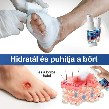Laleia® GlucoDerm lábvédő spray⭐️⭐️