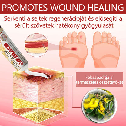 ⭐⭐Laleia® GlucoseGuard bőrmentő krém