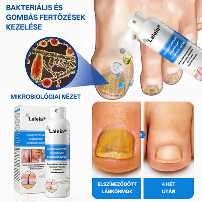⭐⭐⭐Laleia® 🎉Magnézium Gyógynövényes Pszoriázis Spray