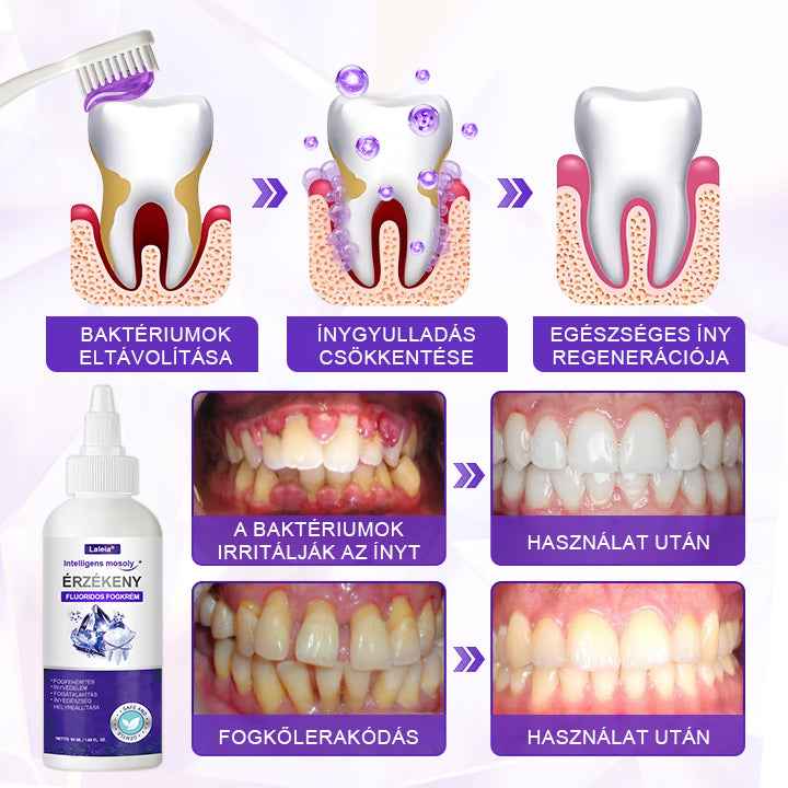 ⭐Laleia® SensiGum Fluoridos Fogkrém