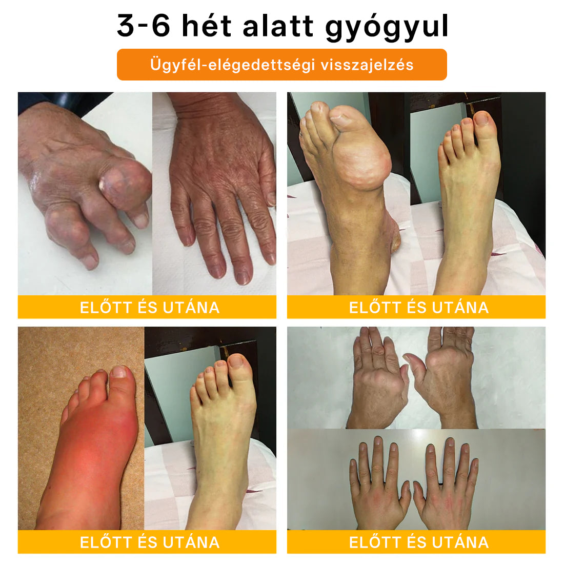 🌿🌿Laleia® Botulinum Toxin és Méhméreg Fájdalomcsillapító Csontgyógyító Krém🐝 (Kifejezetten időseknek & ortopéd szakorvosok ajánlásával)