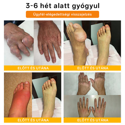 🌿🌿Laleia® Botulinum Toxin és Méhméreg Fájdalomcsillapító Csontgyógyító Krém🐝 (Kifejezetten időseknek & ortopéd szakorvosok ajánlásával)