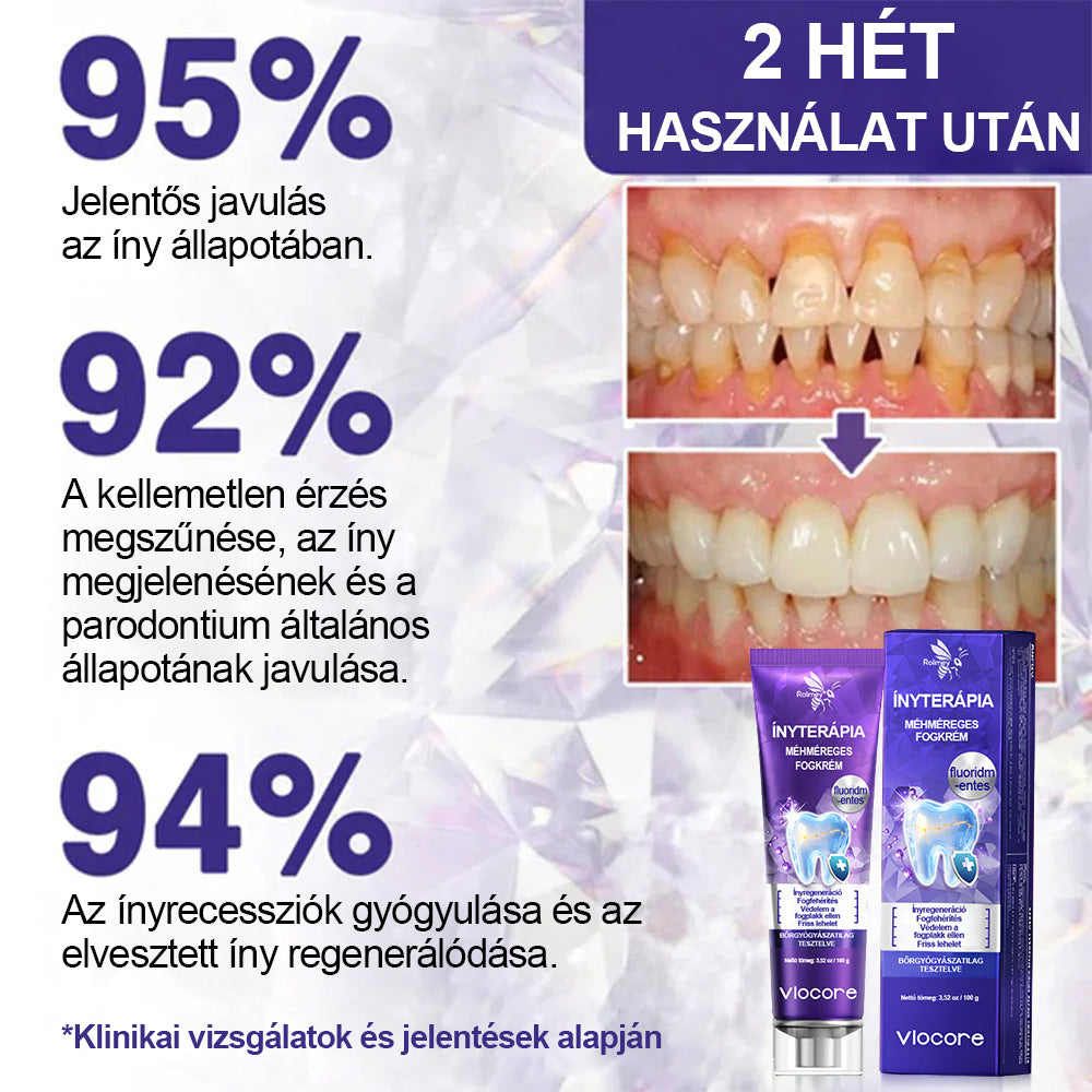 Laleia® VioCore Méhméreg Fogkezelő Fogkrém🌟🌟🌟
