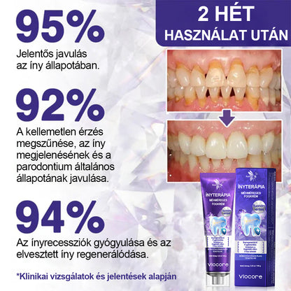Laleia® VioCore Méhméreg Fogkezelő Fogkrém🌟🌟🌟