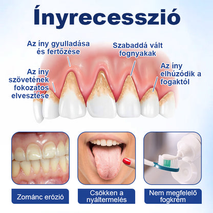 ⭐⭐⭐Laleia® GumViva Szájregeneráló Oldat