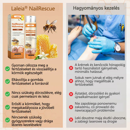 ✅✅✅Laleia® NailRescue méhméreg spray