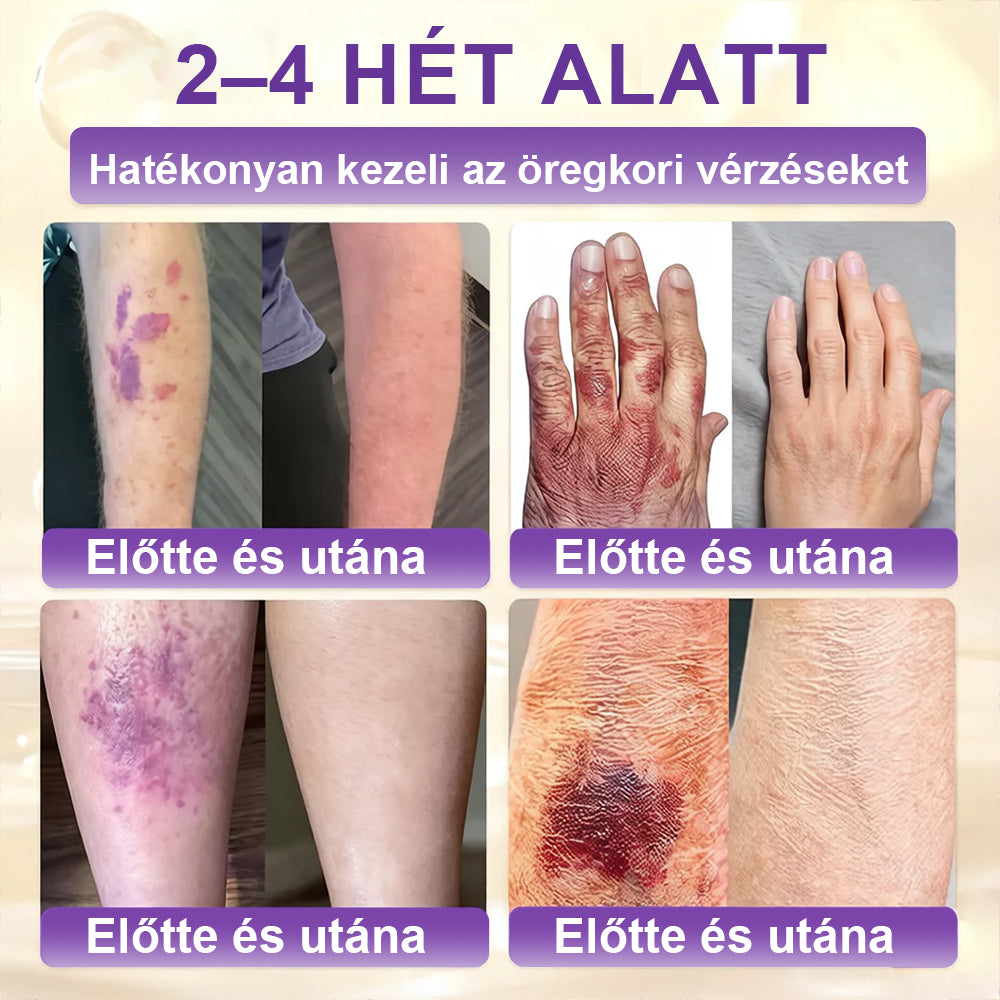 ✨Laleia® Biotin 10 az 1-ben bőr helyreállító krém
