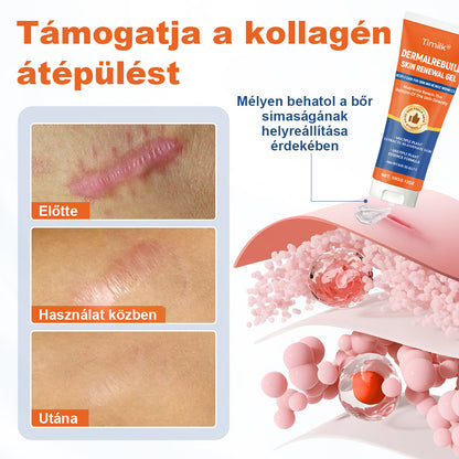🔥🔥Laleia® DermalRebuild bőrfiatalító gél