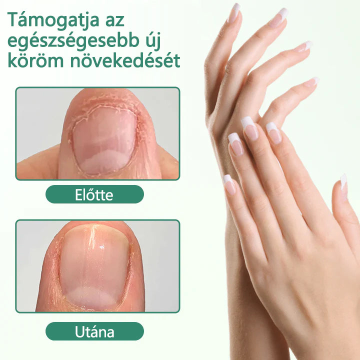 ☁️Laleia® Köröm Detox Behatoló Szérum Toll
