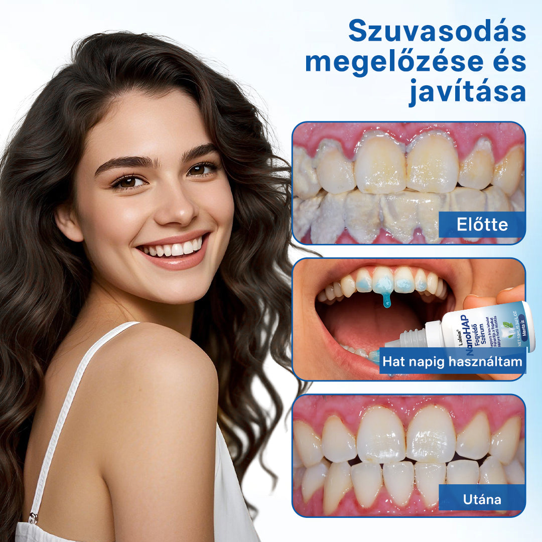 🔥🔥Laleia® NanoHAP Tooth Defense Serum